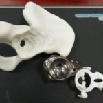 custom-made-hip-joint-implant
