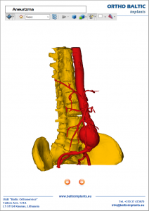 Anatominio modelio 3D pdf failo vizualizacija