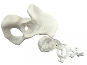 Priešoperacinio planavimo modeliai: klubakaulis, implantas, gidas