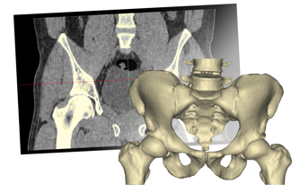 3D anatominė rekonstrukcija