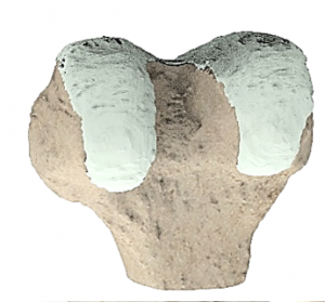 Anatomical model - knee (material: plaster)